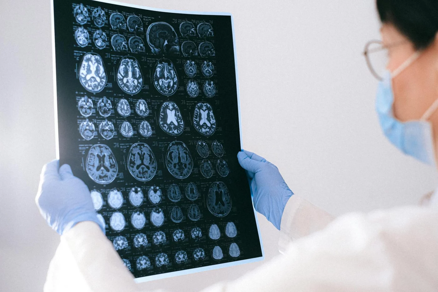 7 Clear Signs to Know When You Should See a Neurologist Neurologist reviewing MRI brain scans during a consultation, explaining when should you see a neurologist