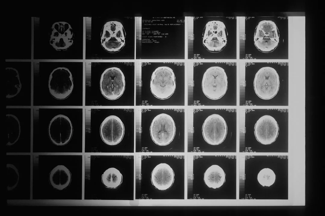What Part of the Brain Controls Balance and Coordination? MRI scans highlighting brain regions linked to what part of the brain controls balance and coordination