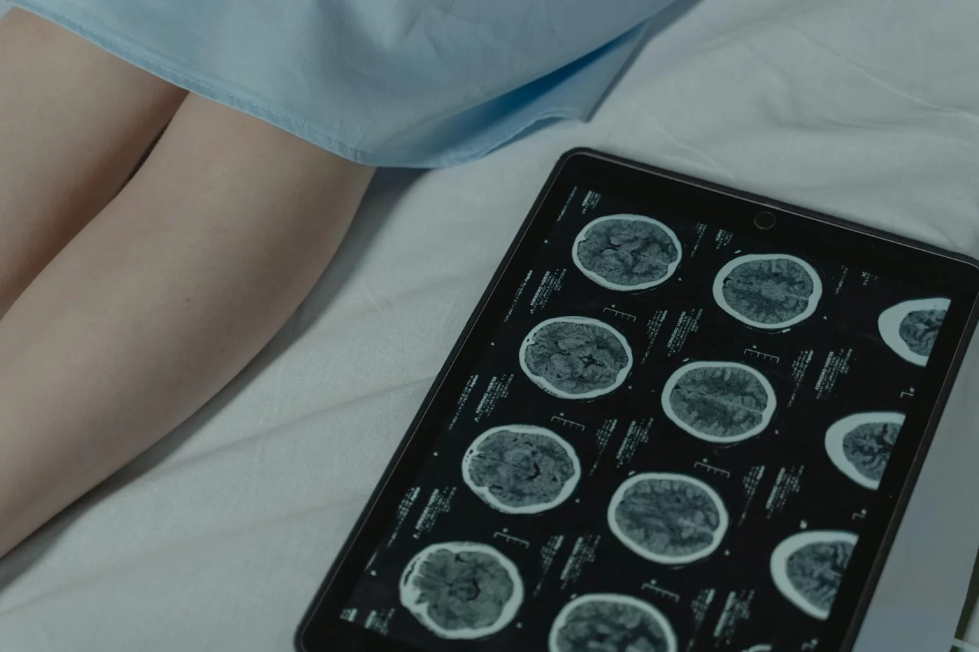 The 10% Brain Myth, Debunked: Where It Came From and What Neuroscience Says Brain CT scan on a tablet in a hospital room illustrating where did the 10 brain myth come from